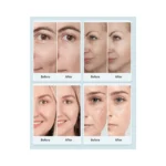 LED veido kaukė - Image 2