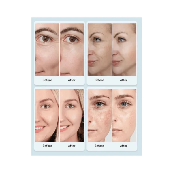 LED veido kaukė - Image 2